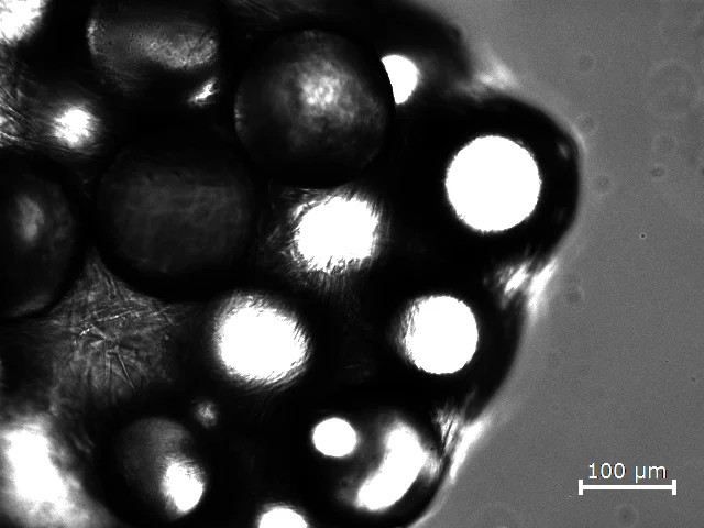 Bright-field image of cells on collagen-coated microcarriers